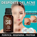 Serum Secador de Barros con Protección UV y Zinc Oxide