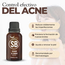 Serum Secador de Barros con Protección UV y Zinc Oxide