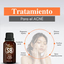 Serum Secador de Barros con Protección UV y Zinc Oxide