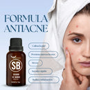 Serum Secador de Barros con Protección UV y Zinc Oxide